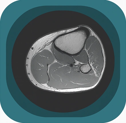 MRI leg anatomy icon